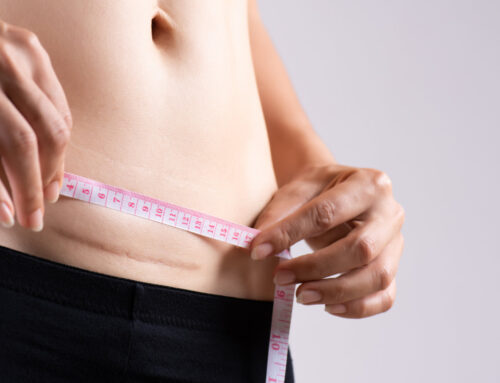 C-Section Recovery: Ethos Pelvic Health and Wellness Guide