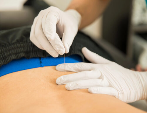 Pelvic Floor Dry Needling
